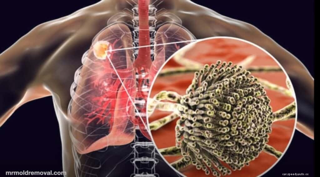 Seek and Destroy: How to Remove Mildew and Mold From a Car