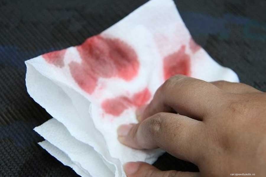 How to Remove Blood Stains from Car Seats