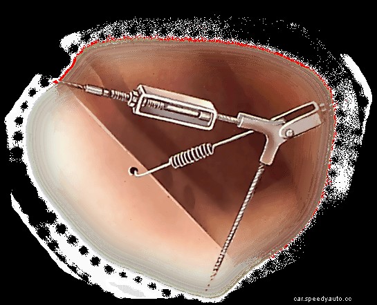 Replacing a handbrake cable