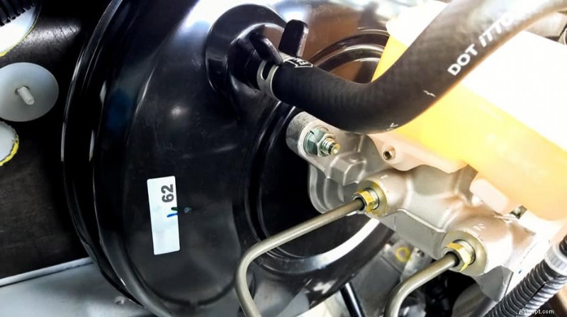 Why the Service Brake Assist Light Turns On—and How to Fix It