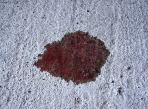 How can I Stop My Transmission From Leaking Fluid?