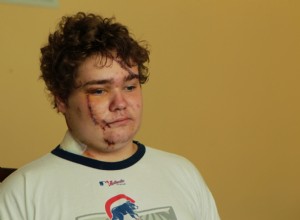 You Should Never Ignore These 6 Symptoms After a Car Accident