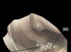 Adjusting the brakes