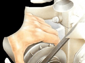 Removing and refitting a dynamo pulley